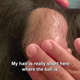 Illustration for article titled Bada Bing, iDr. Pimple Popper/i Meets Bada Boob